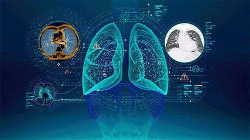 在医疗IT行业，什么是人工智能投资的最低要求？